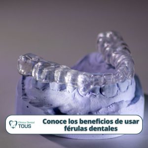 Descubre los beneficios de usar férulas dentales