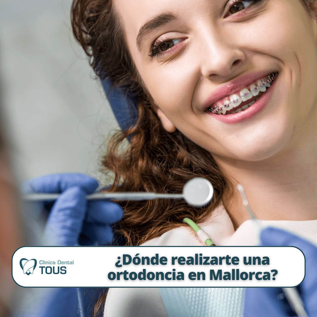 Encuentra un tratamiento especializado de ortodoncia en Mallorca