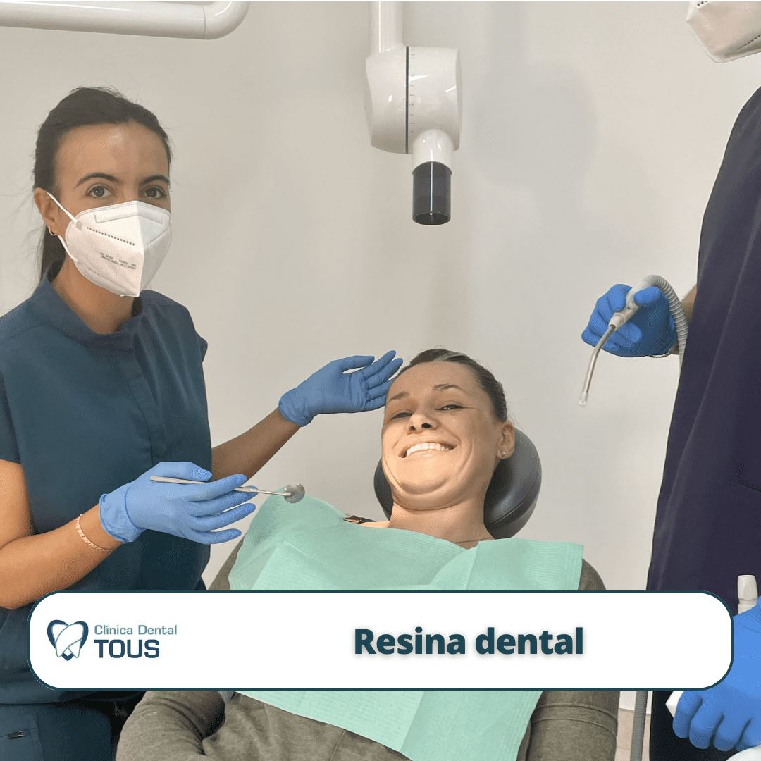 Resina dental en Palma de Mallorca Clínica dental Tous