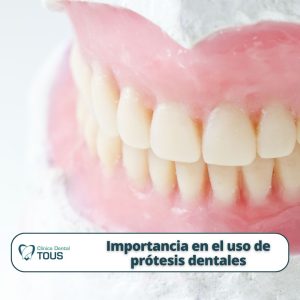Descubre los beneficios de usar prótesis dentale