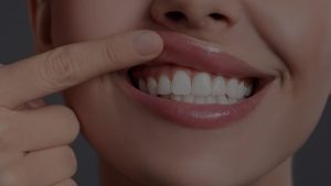 Periodoncia, tratamientos para las encías en Palma de Mallorca | Clínica Dental Tous