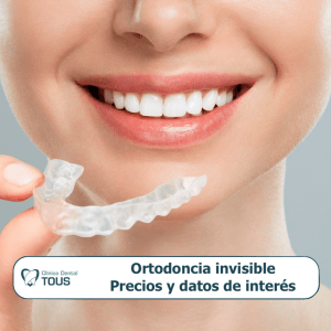 Ortodoncia invisible Precio y otros datos de interés - portada