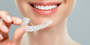 Ortodoncia invisible: Precio y otros datos de interés