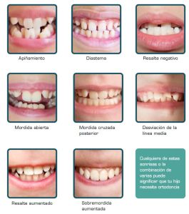 ¿Cuándo se debe comenzar un tratamiento de ortodoncia? | Clínica Dental Tous