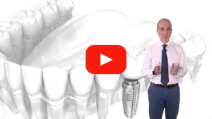 Ventajas de los implantes dentales | Clínica Dental Tous, implantes dentales en palma de Mallorca